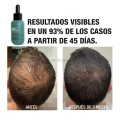 big_tahe-peptide-t98-serum-koncentrat-przeciw-wypadaniu-wlosow-50ml-efekt-przed-po