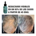 big_tahe-peptide-t98-serum-koncentrat-przeciw-wypadaniu-wlosow-50ml-efekt-przed-po