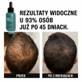 before-after-1.webp