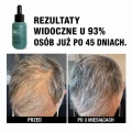 before-after-2.webp